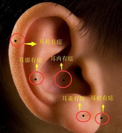 耳痣|耳朵长痣的位置图解 耳朵长痣的位置图解有福气